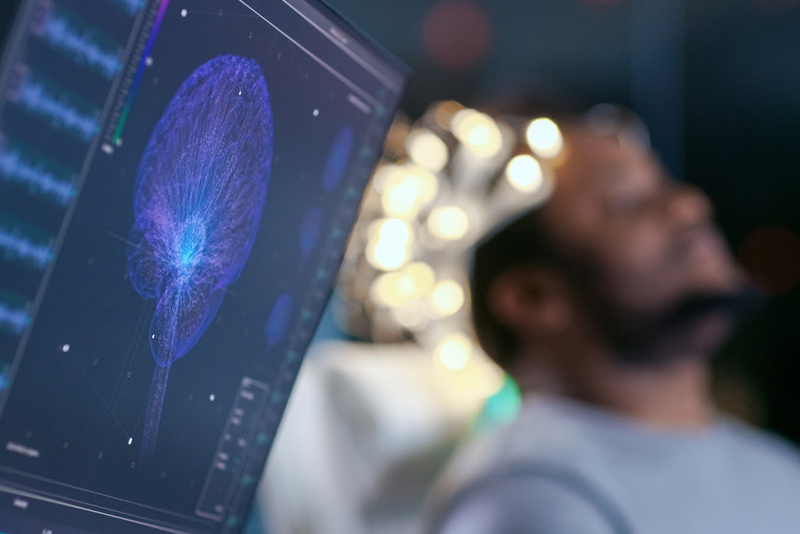 Sleep Study Cost Sleep Study Cost